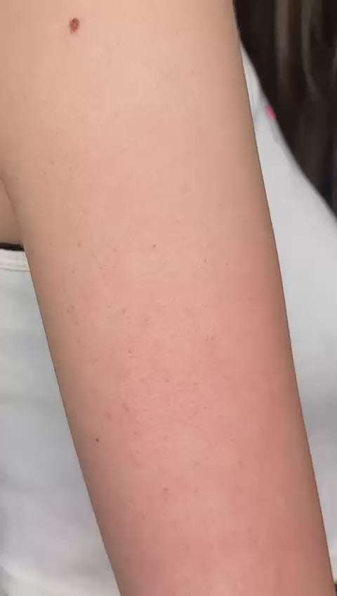 Charger la vidéo : &lt;p&gt;Élimine 98% des impuretés !&lt;/p&gt;&lt;p&gt;Adieu la peau de fraise, les poils incarnés, les zones sombres. &lt;/p&gt;&lt;p&gt;Bonjour à une peau lisse et éclatante en 3 minutes. &lt;/p&gt;&lt;p&gt;&lt;/p&gt;